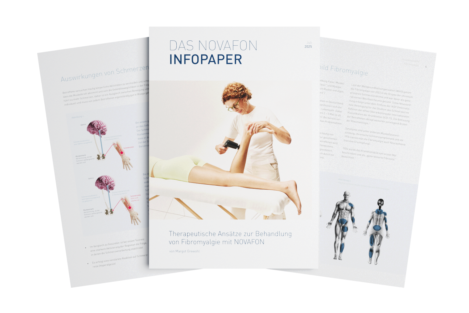 Infopaper Fibromyalgie